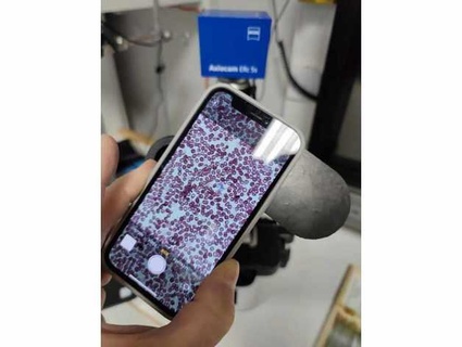 mobile camera microscope spacer spotmatic 3d print model - Mito3D