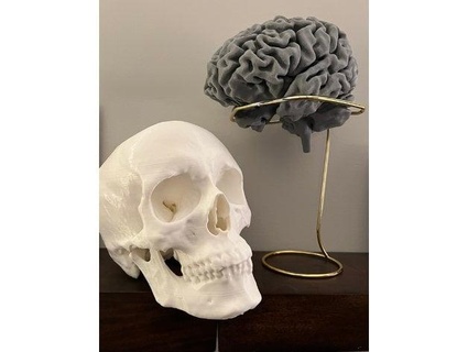 umano cranio viso nelbansal 3d print model - Mito3D
