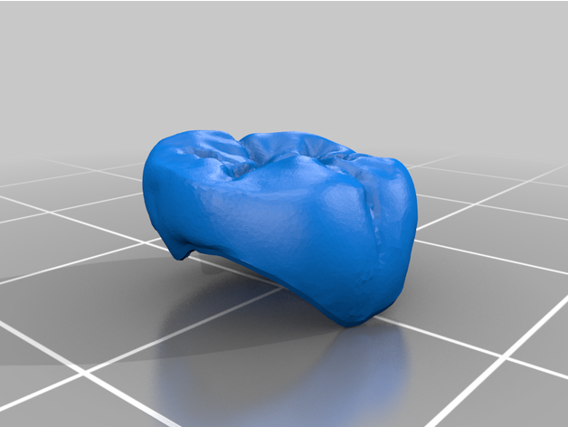 Dental Krone ayjoshi 3D print model - Mito3D