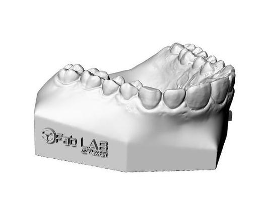 base zocalada by fablabnewton dental dentalmodell zahnheilkunde intraoral scan kieferorthopädie skandalös oberkieferscan 3d print model - Mito3D
