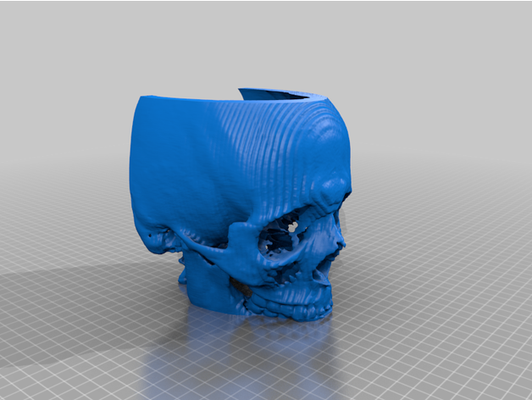 oberkiefer gesichts knochen ct 3d scan by jackmapo 3d print model - Mito3D