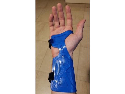 pulso tala f lista ferula muñeca braçadeira braço fundida órtese by tomafb descansar 3d print model - Mito3D
