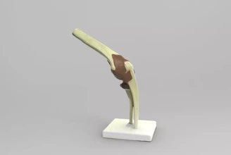anatomical model elbow joint 3d printing - threeding anatomy science human 12 3d print model - Mito3D