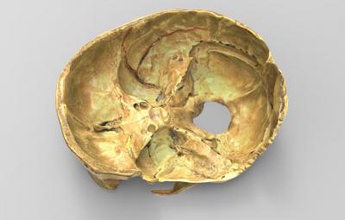 la moitié du crâne science 3D modèle d'impression, l'impression fichier, imprimable modèle, en de conception, d'impression 3d, moitié, crâne, l'anatomie, science, l'homme 3d print model - Mito3D
