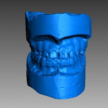 human denture science 3D printing model, file, printable design, 3d print, teeth, denture, human, artec 3d print model - Mito3D