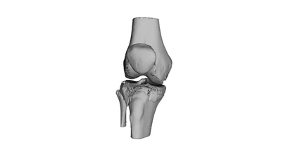 human knee 3d printing model - threeding knee 3d print model - Mito3D
