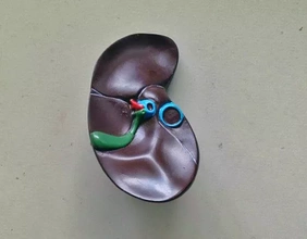 humano fígado 3d impressão modelo trio anatomia ciência 3d print model - Mito3D