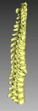 umano colonna vertebrale 3d stampa modello treding osso artec 3d print model - Mito3D