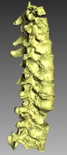 humano coluna 3d impressão modelo trio osso 3d print model - Mito3D