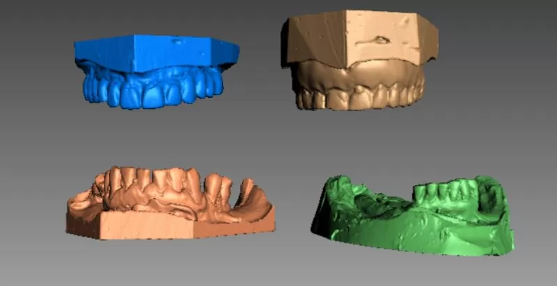 humano dentes 3d impressão modelo trio artec dentadura 3D print model - Mito3D