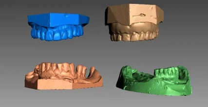 Humain dents 3d impression modèle trio artec dentier 3d print model - Mito3D