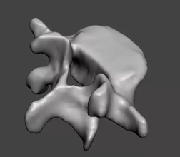 humano vértebra l5 3d impresión modelo trío hembra columna vertebral 3d print model - Mito3D
