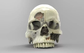 modèle nerfs Humain crâne 3d impression trio anatomie science 3d print model - Mito3D
