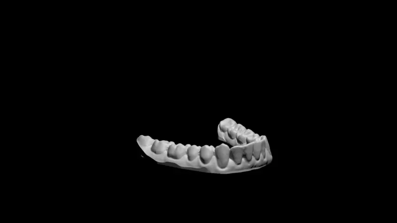 dientes 3d impresión modelo trío 3D print model - Mito3D