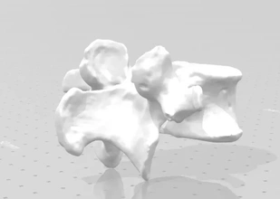 vértebra lombar 3d impressão modelo trio 3d print model - Mito3D