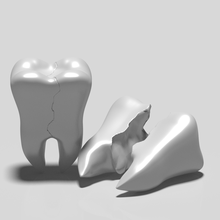 toothache day broken tooth art ache february 3d print model - Mito3D