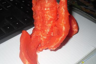 aneurisma dell'aorta addominale altri corpo salute medico medical imaging 3d print model - Mito3D