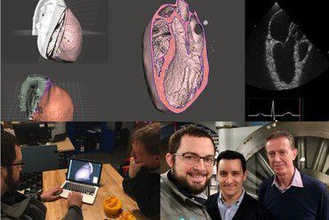 anatômico coração cortado 4 tee pontos de vista educação médica cardiologia formação ultra-som echo 3d print model - Mito3D