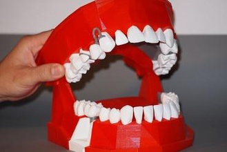 dentaire modèle de démonstration mod le d monstration L'imprimante 3d pièces améliorations dents dent la médecine communication 3d print model - Mito3D