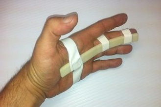 finger splint other medical emergency 3d print model - Mito3D