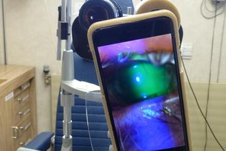 Schlitz-Lampe-imaging-adapter maker diy Spaltlampe der Augenheilkunde Medizin Chirurgie ophthalmicdocs smartphone-adapter 3d print model - Mito3D