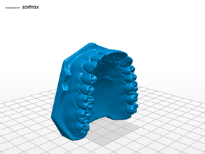 maxilar de la médecine dentaire 3d print model - Mito3D